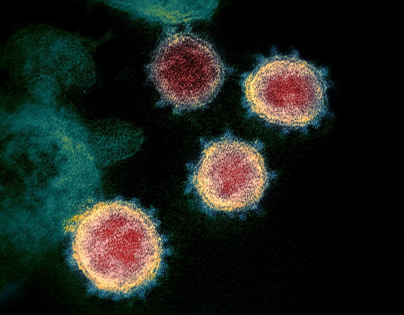 Microscoop-plaatje van SARS-CoV-2 virus (bron: Wikipedia)